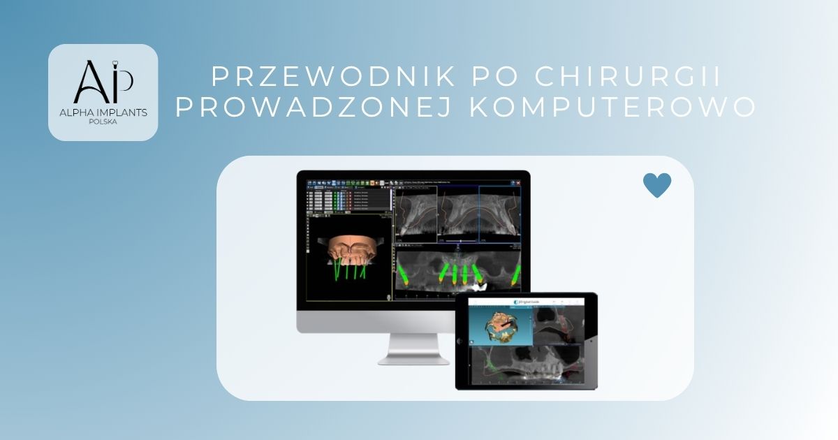 Przewodnik po chirurgii prowadzonej komputerowo